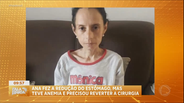 mulher-precisa-reverter-bariatrica-apos-perder-muito-peso-e-desenvolver-anemia