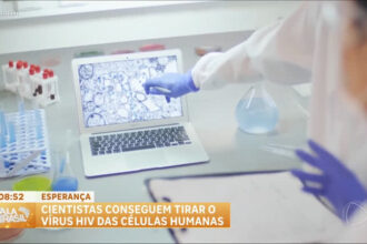 virus-hiv-e-eliminado-de-celulas-humanas-em-estudo-na-holanda