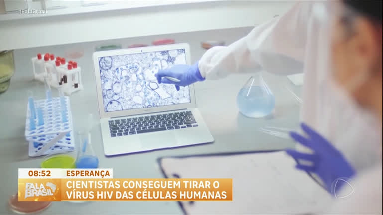 virus-hiv-e-eliminado-de-celulas-humanas-em-estudo-na-holanda