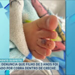 mae-denuncia-que-filho-de-3-anos-foi-picado-por-cobra-dentro-de-creche