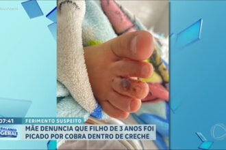 mae-denuncia-que-filho-de-3-anos-foi-picado-por-cobra-dentro-de-creche