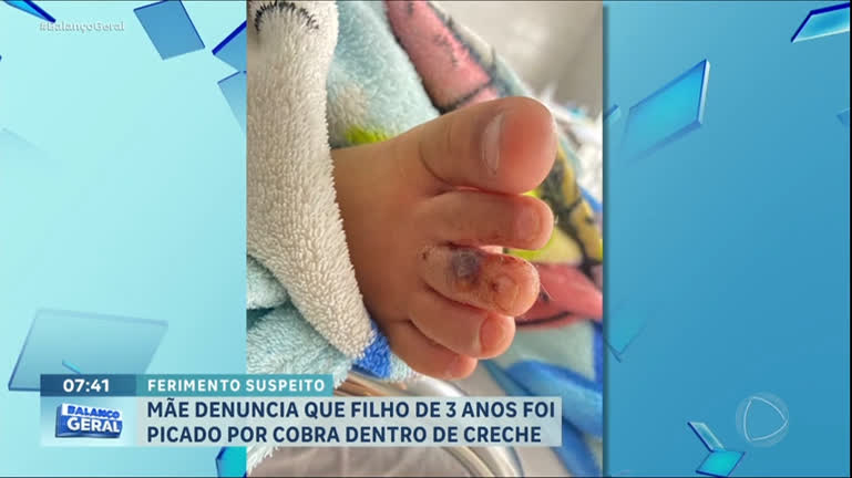 mae-denuncia-que-filho-de-3-anos-foi-picado-por-cobra-dentro-de-creche