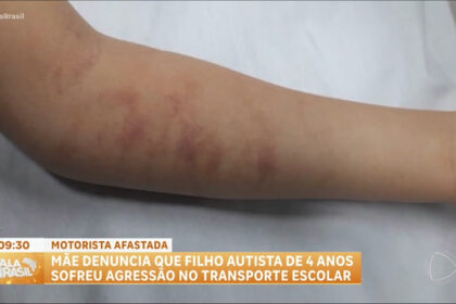 denuncia:-crianca-autista-e-agredida-por-motorista-de-transporte-escolar