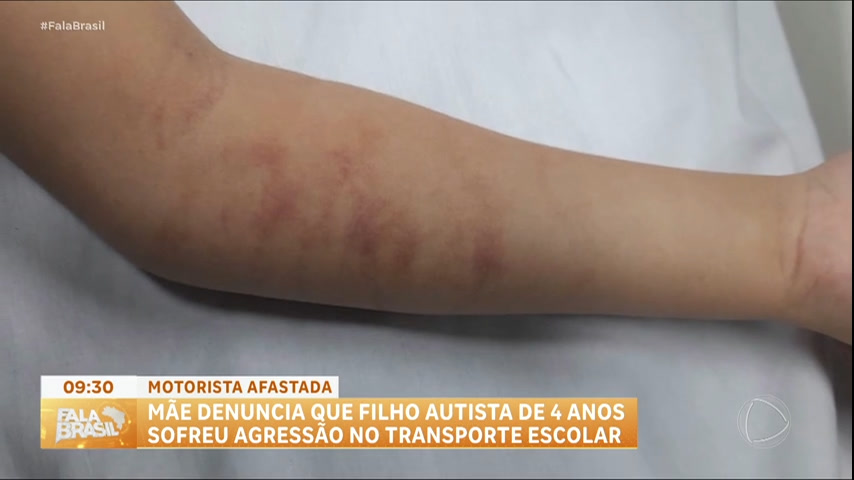 denuncia:-crianca-autista-e-agredida-por-motorista-de-transporte-escolar