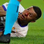 companheiros-de-mbappe-atualizam-estado-do-atacante-apos-fratura-no-nariz