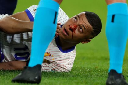 companheiros-de-mbappe-atualizam-estado-do-atacante-apos-fratura-no-nariz