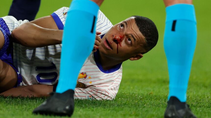 companheiros-de-mbappe-atualizam-estado-do-atacante-apos-fratura-no-nariz